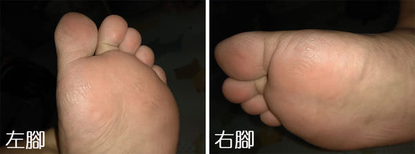 歐肌膚腳部細紋1.jpg