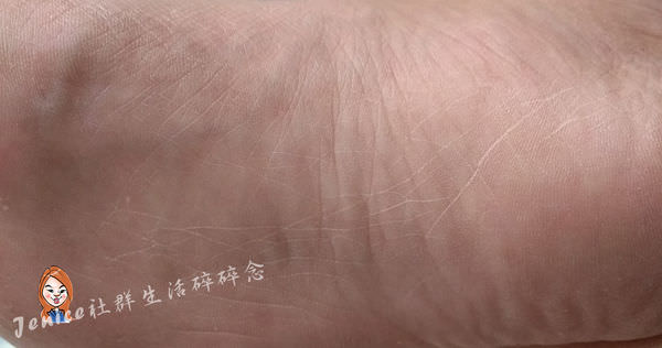 歐肌膚腳部細紋3.jpg