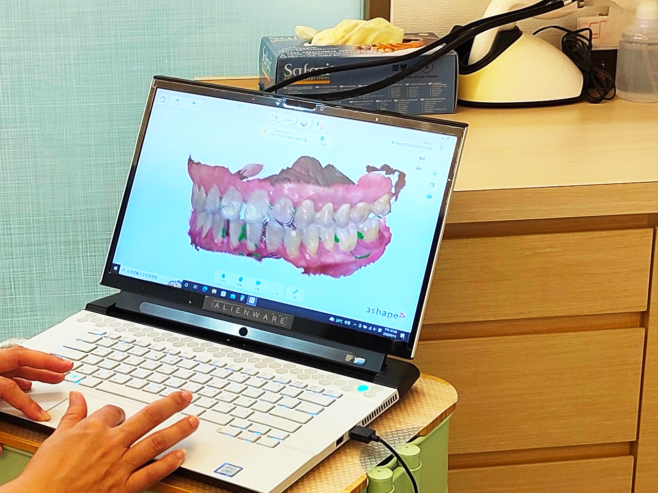 安曼牙醫-口腔掃描成影可以讓患者看到最貼近自己牙齒的狀況